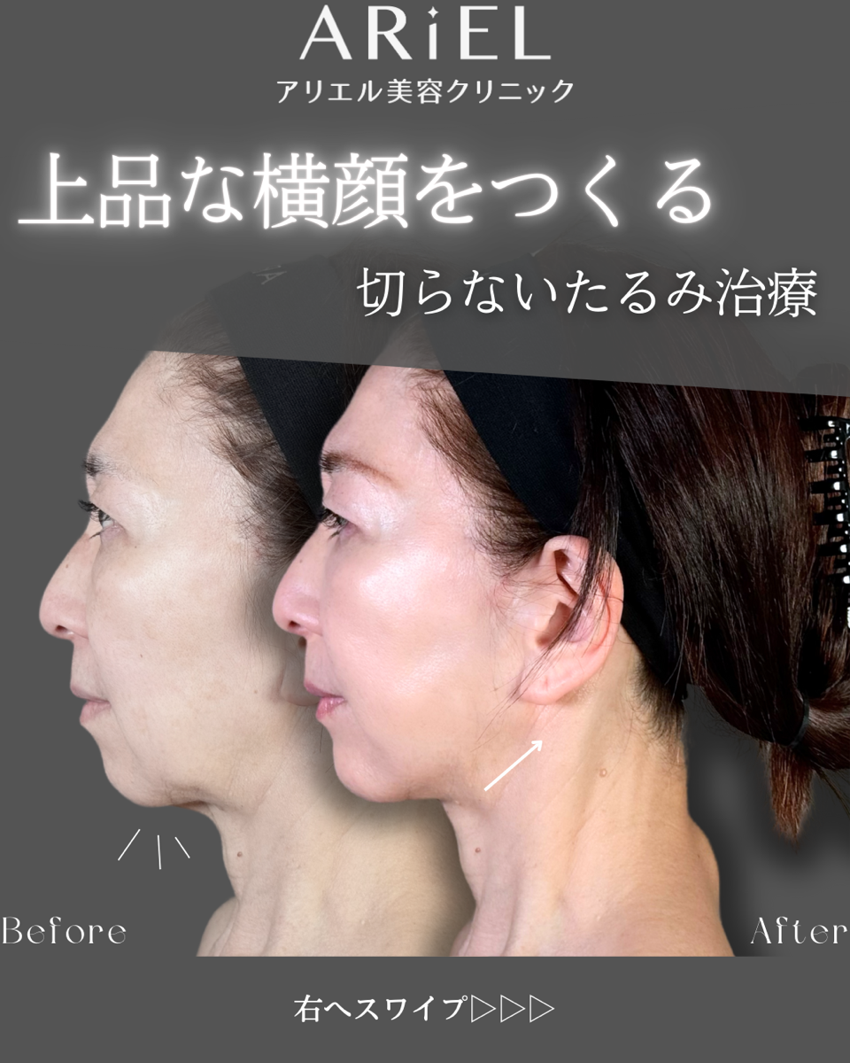 No.9026の症例写真
